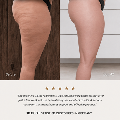 Lonvela Sculpt Pro™