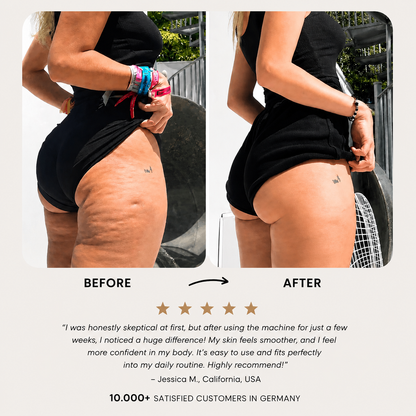 Lonvela Sculpt Pro™